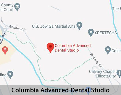 Map image for Options for Replacing Missing Teeth in Columbia, MD
