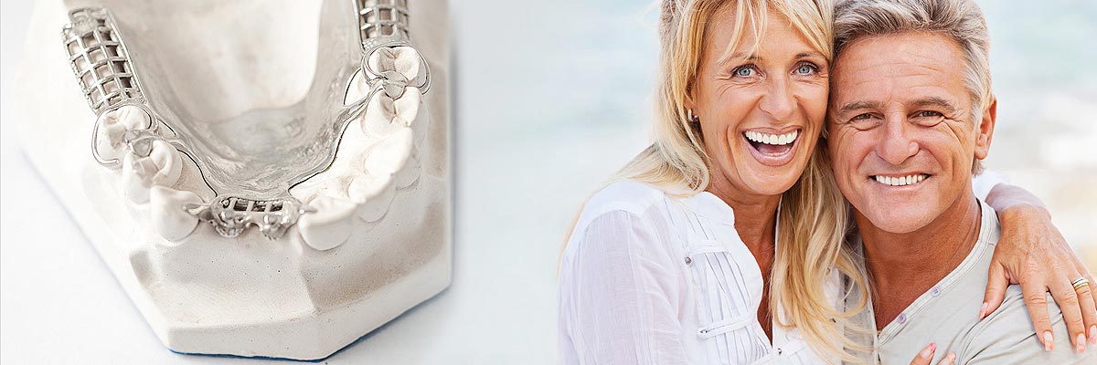 Columbia Implant Supported Dentures