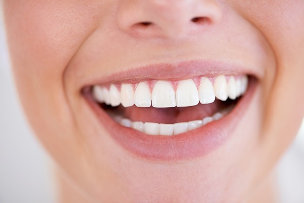 Ways To Know If Professional Teeth Whitening Is Right For You